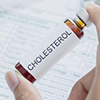 Eksperci: prawie 20 mln Polakw ma zbyt wysoki poziom cholesterolu