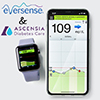 Wkrtce Ascensia Diabetes Care nowym dystrybutorem systemu Eversense i Eversense XL take w Polsce