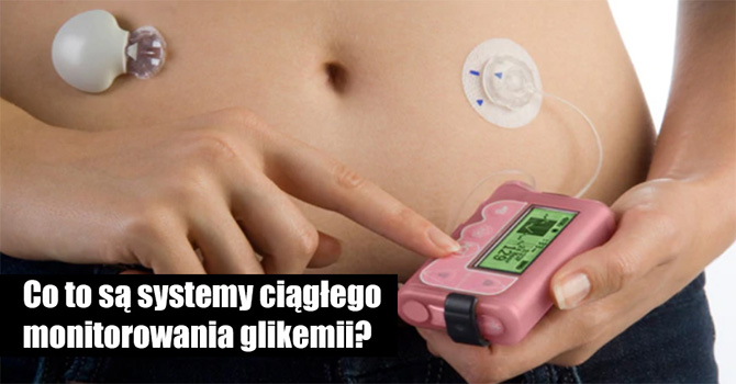 Co to s systemy cigego monitorowania glikemii?