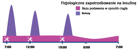 Trzustka a pompa