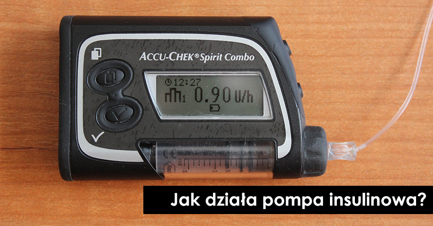 Jak działa pompa insulinowa?