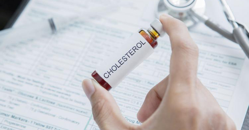 Eksperci: prawie 20 mln Polaków ma zbyt wysoki poziom cholesterolu