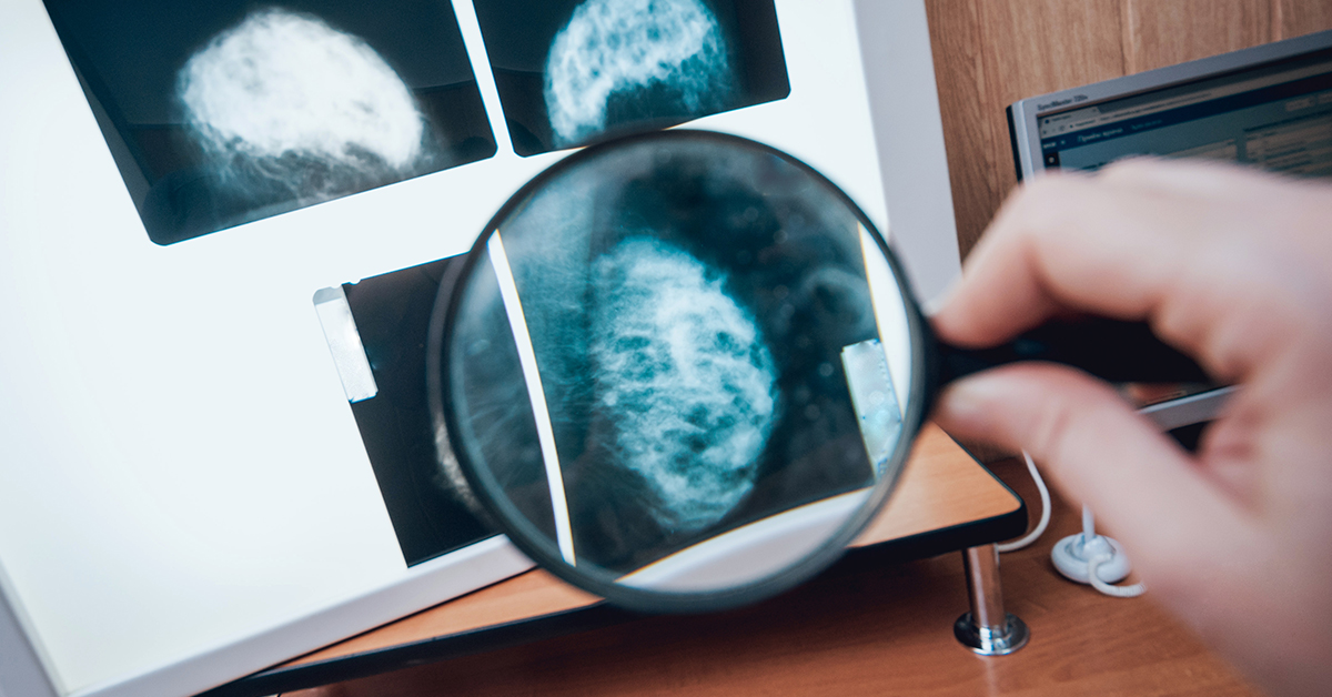 Profilaktyka raka piersi, Mammografia - co ile się badać?