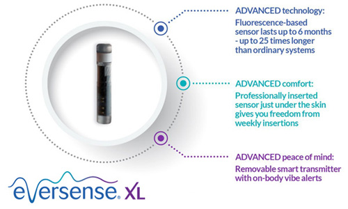 Eversense XL