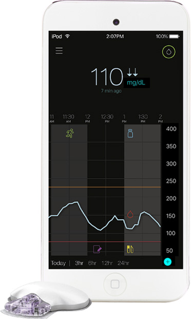 Guardian Connect - System Cigego Monitorowania Glikemii (CGM)