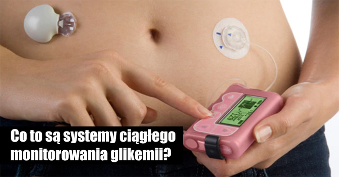 Co to są systemy ciągłego monitorowania glikemii?