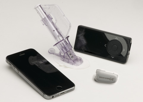 Dexcom G5 - mobilny system ciągłego monitoringu glikemii