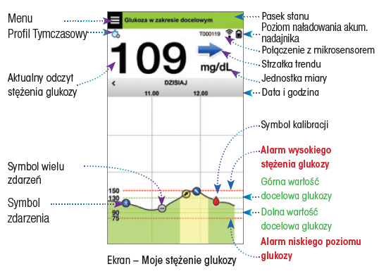 System Eversense CGM