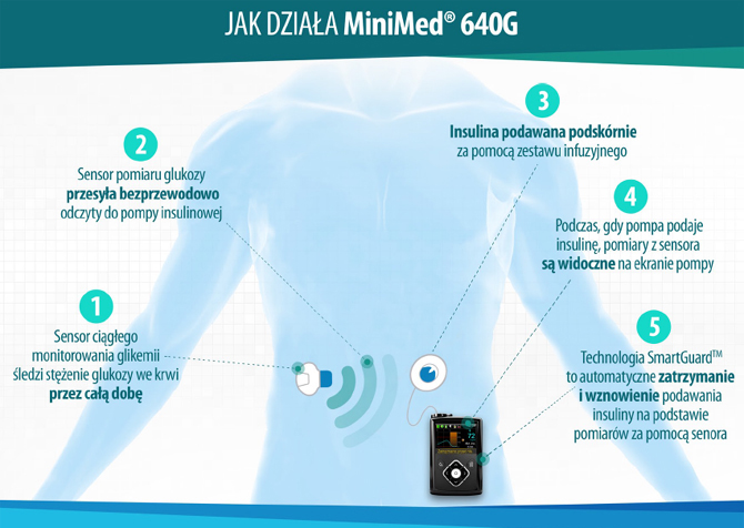 Medtronic ogasza premier systemu MINIMED 640G