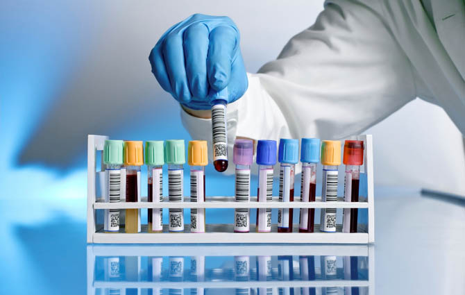 Jak zdiagnozowa zesp metaboliczny?