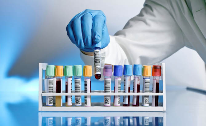 Diagnozowanie chorób metabolicznych