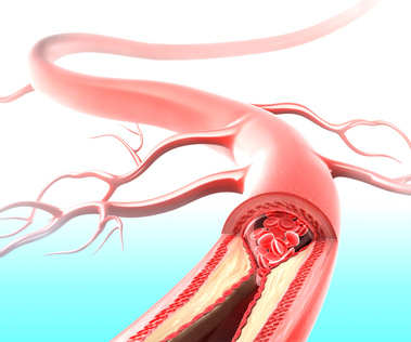 Dlaczego obawiamy się cholesterolu?