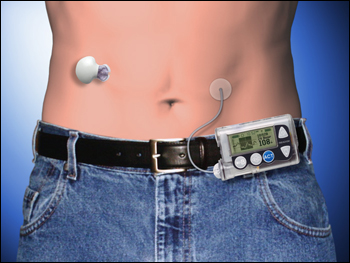 Pompa insulinowa Paradigm 722 Real-Time